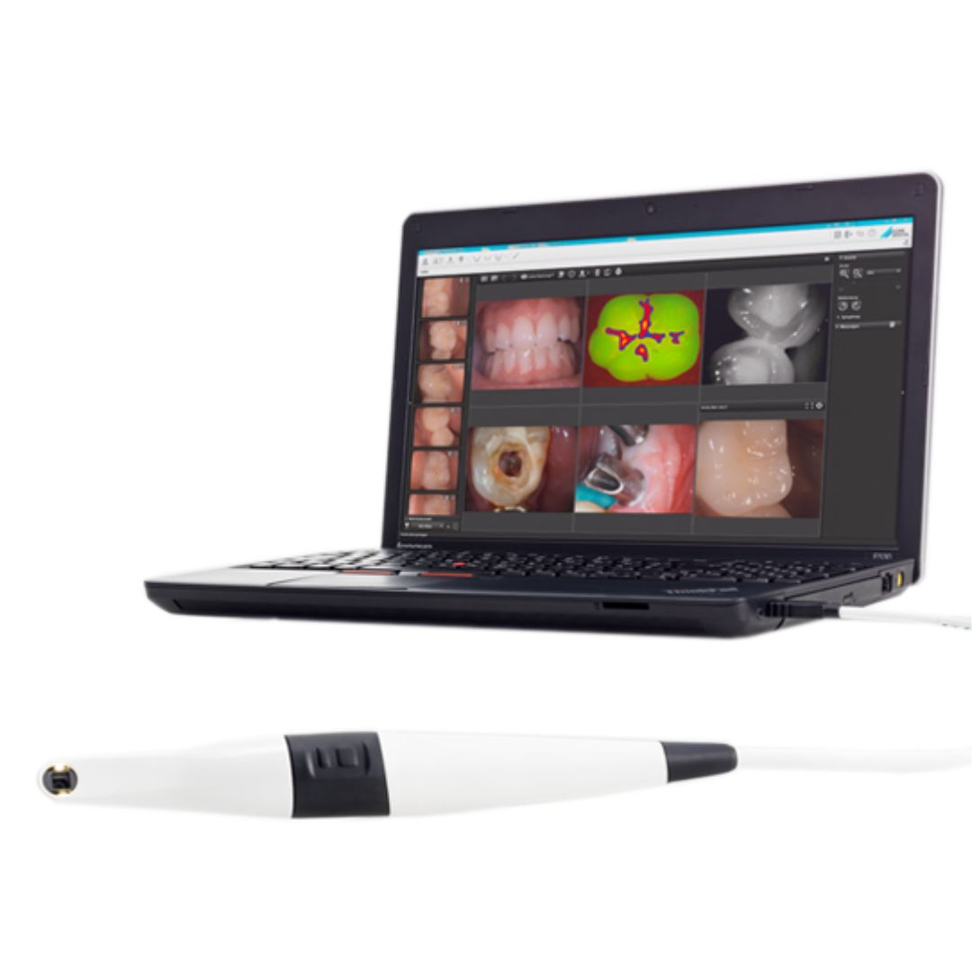 galit-intraoralkamera-vistacam-ix-hd-smart-dental-kamera image 7