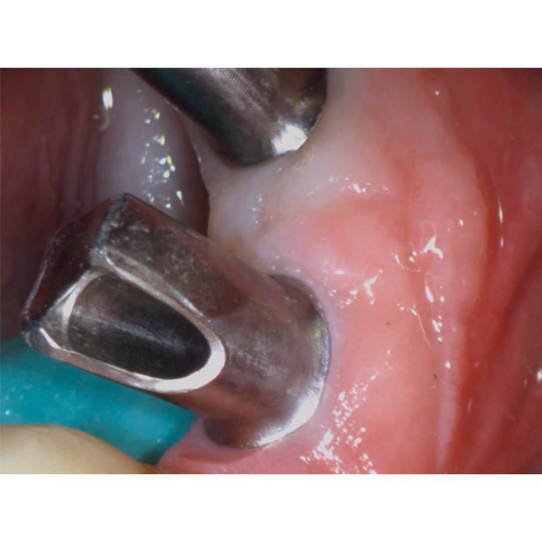 galit-intraoralkamera-vistacam-ix-hd-smart-dental-kamera image 6
