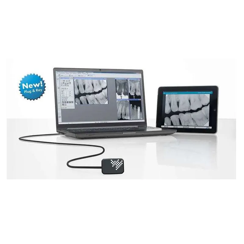 galit-vista-ray-7-r-ntgensensor-digitales-r-ntgen image 1