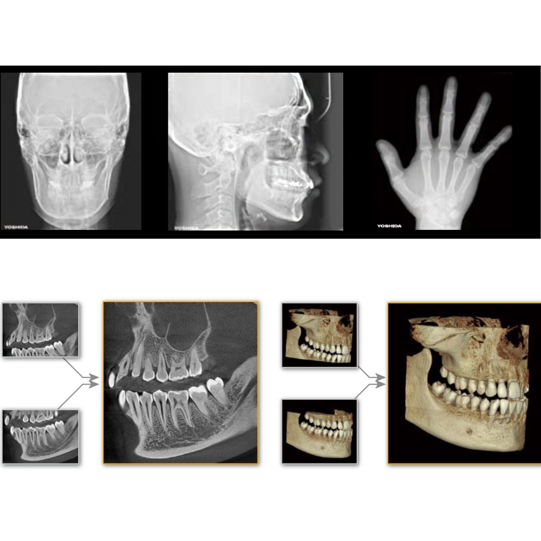 galit-x-era-smart-r-ntgensystem-dental-r-ntgenger-t image 4