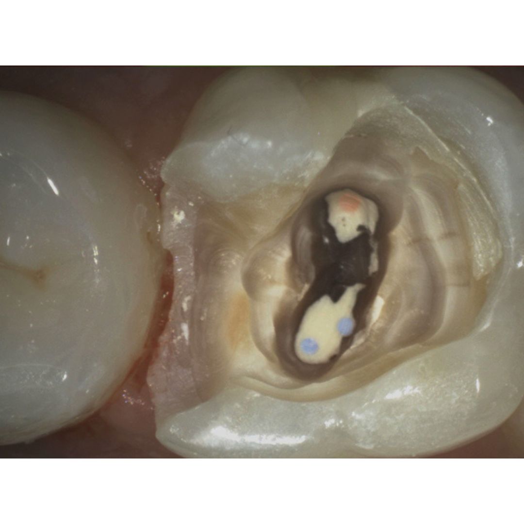 galit-intraoralkamera-vistacam-ix-hd-smart-dental-kamera image 4