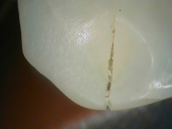 d-rr-dental-vistacam-ix-intraoralkamera-praxis image 5