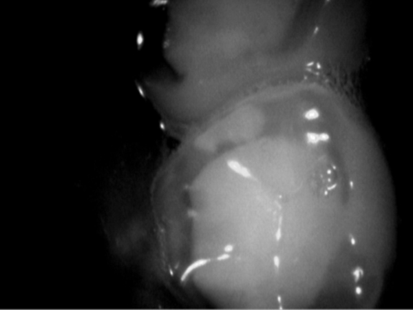 d-rr-dental-vistacam-ix-intraoralkamera-praxis image 2