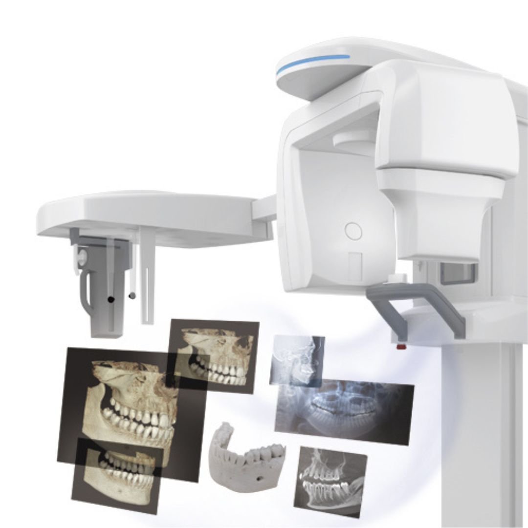 galit-x-era-smart-r-ntgensystem-dental-r-ntgenger-t image 3