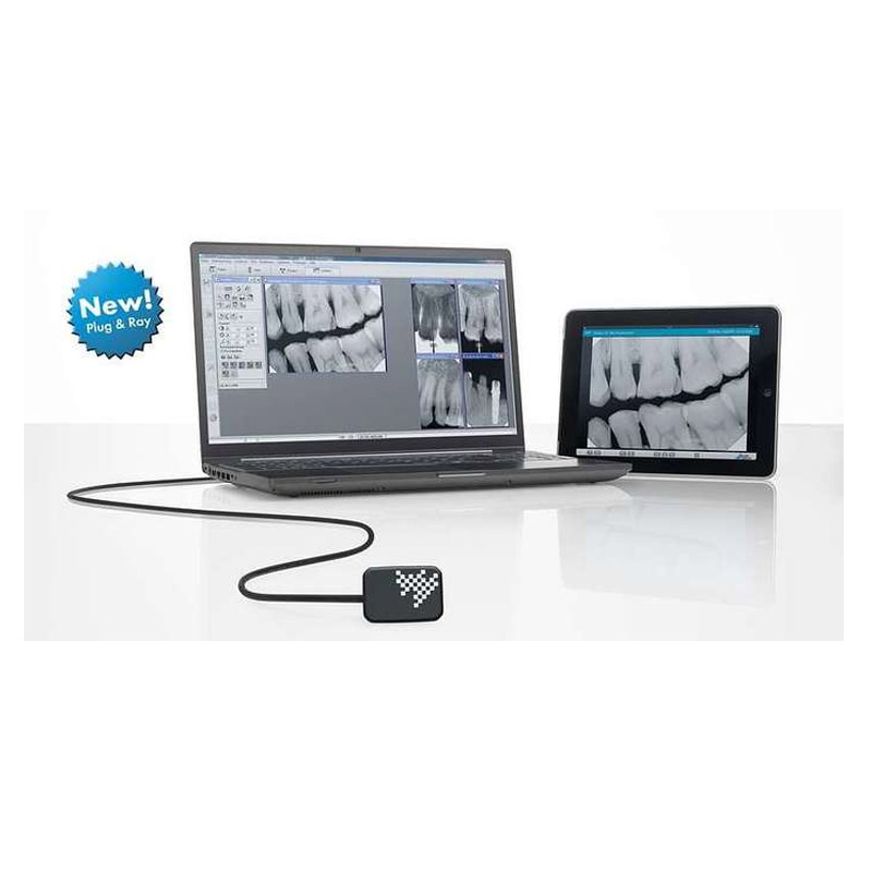 galit-vista-ray-7-r-ntgensensor-digitales-r-ntgen image 1