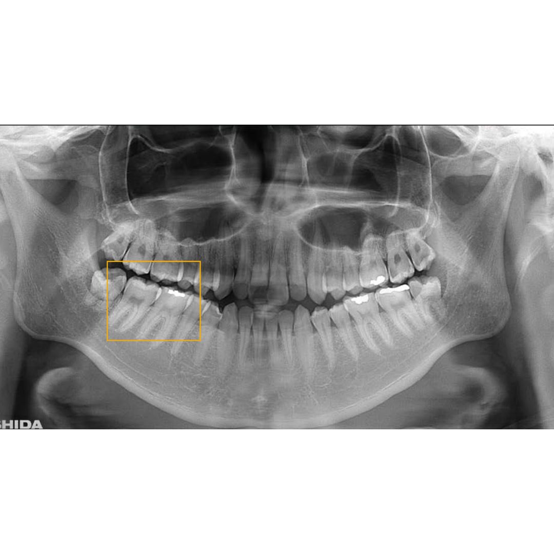 galit-x-era-smart-r-ntgensystem-dental-r-ntgenger-t image 5