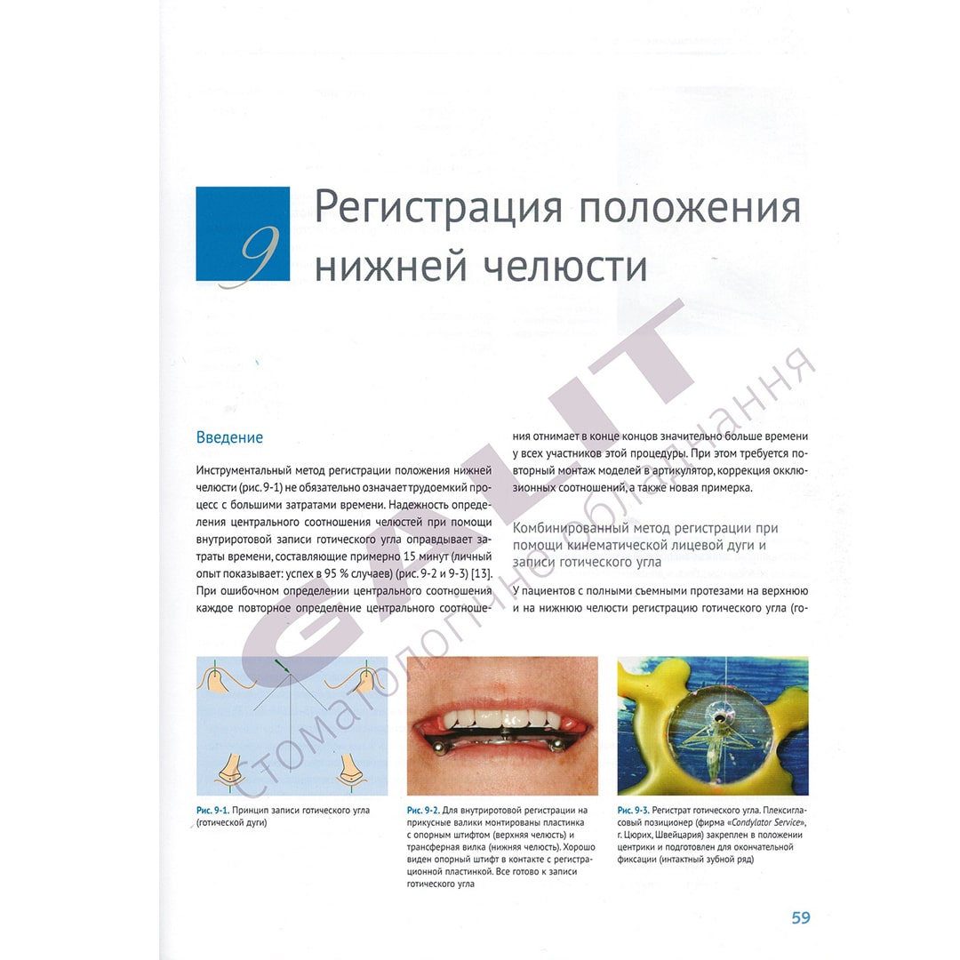 galit-dental-training-models-lehrbuch-funktion-und-sthetik image 4