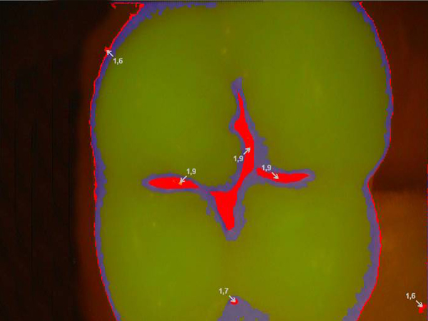 d-rr-dental-vistacam-ix-intraoralkamera-praxis image 4