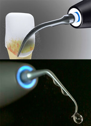 satelec-newtron-p5-xs-b-led-ultraschall-scaler-led image 4