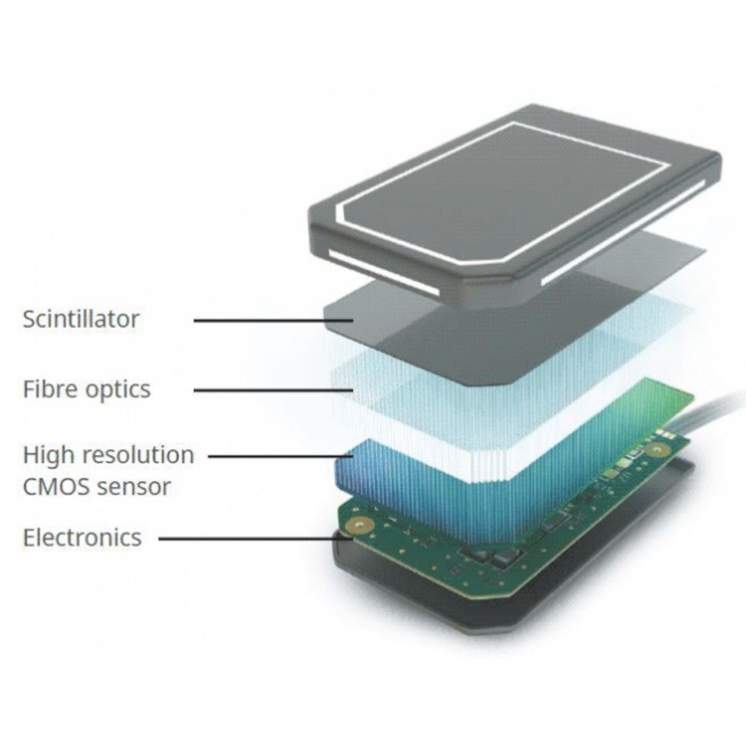 acteon-sopix-2-inside-rvg-sensor-digitales-r-ntgen image 4